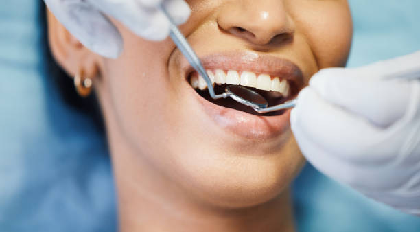 Best Emergency Root Canal Treatment in Woodbury, NJ