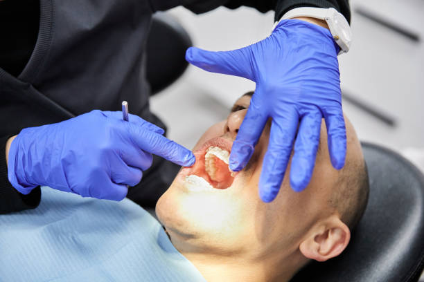 Best Emergency Wisdom Teeth Removal in Woodbury, NJ