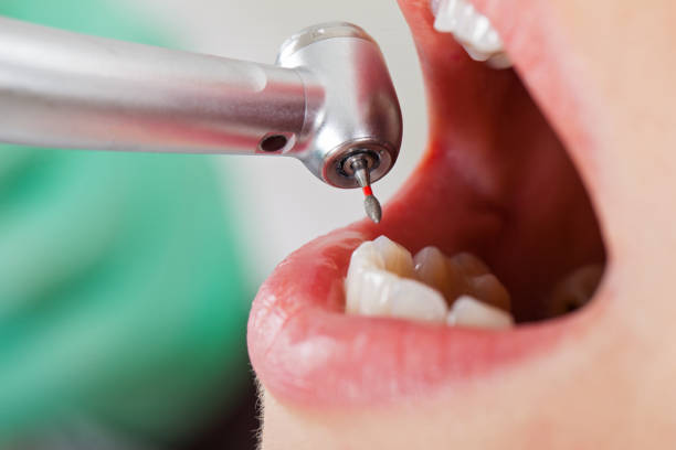 Best Emergency Treatment for Toothache in Woodbury, NJ